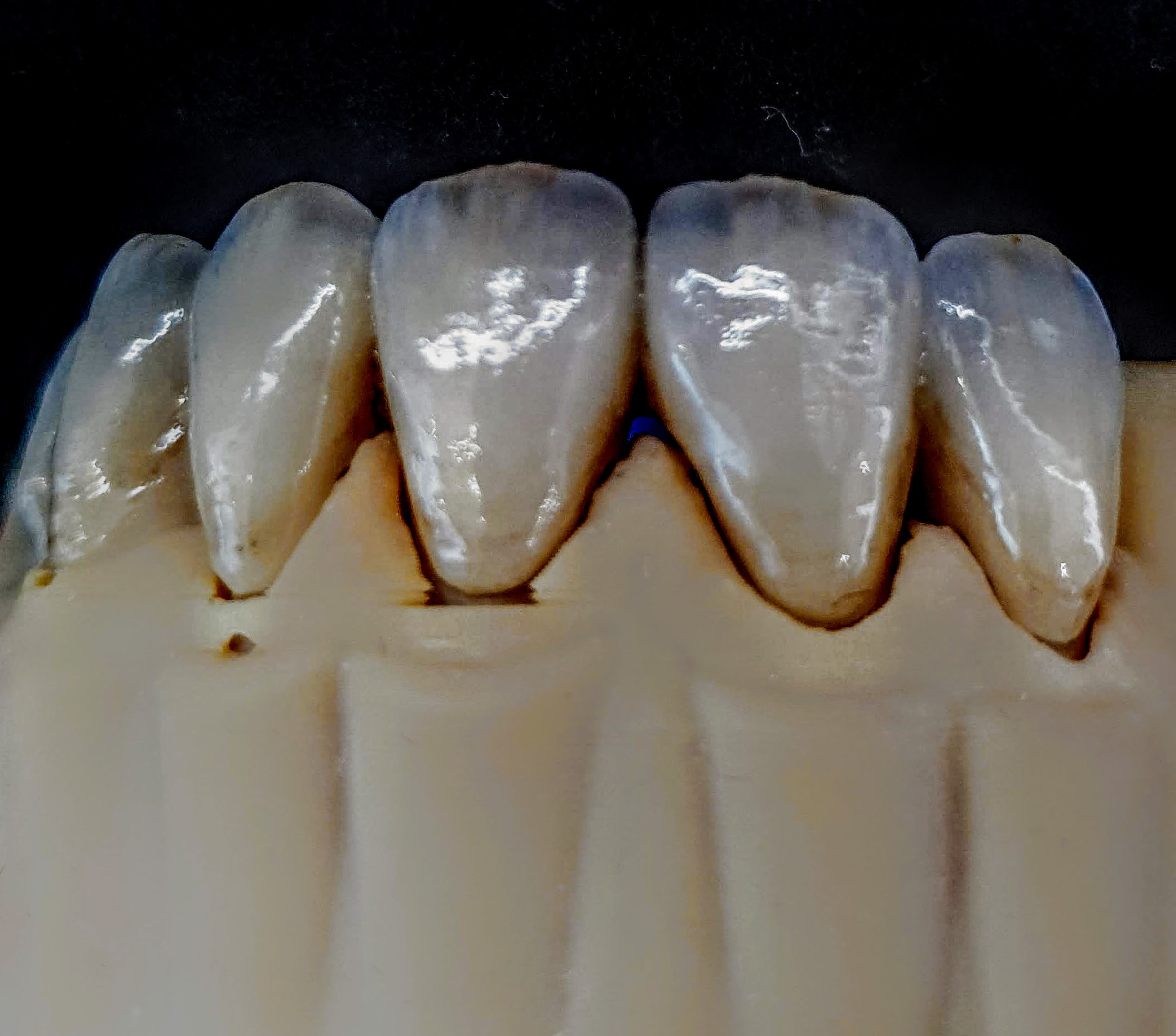 slide 14